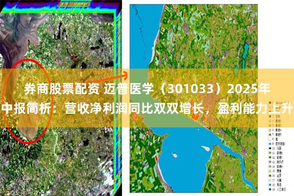 券商股票配资 迈普医学（301033）2025年中报简析：营收净利润同比双双增长，盈利能力上升